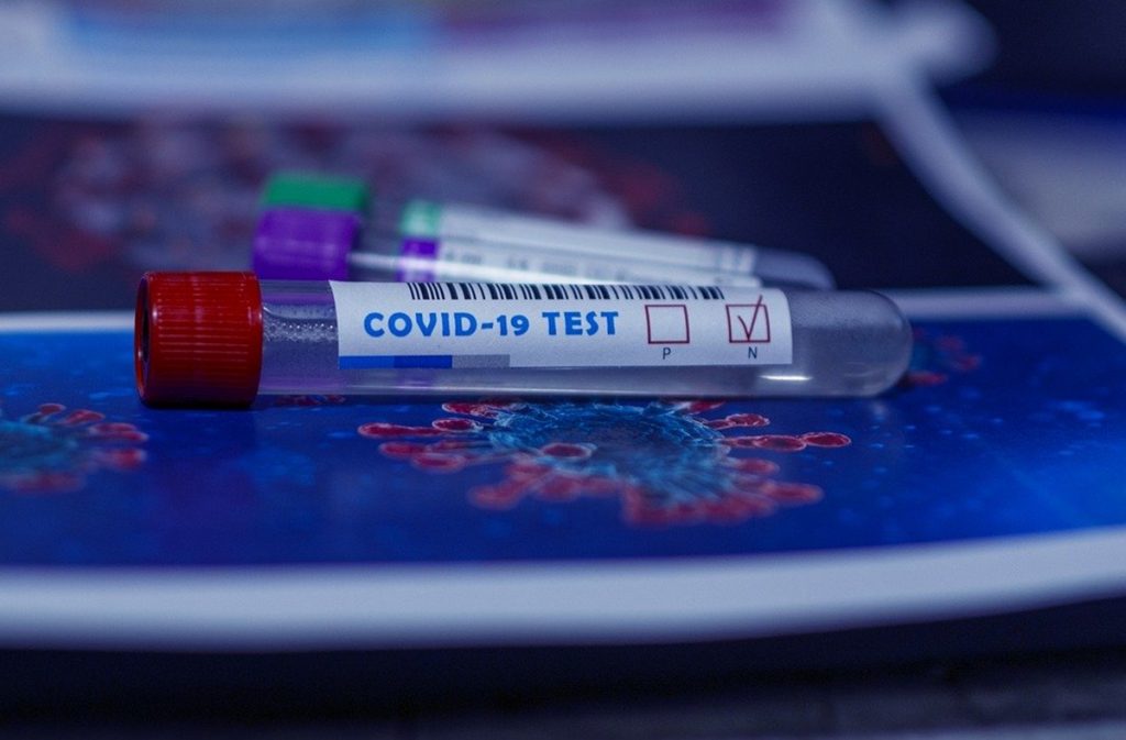 Test coronavirus. Pixabay