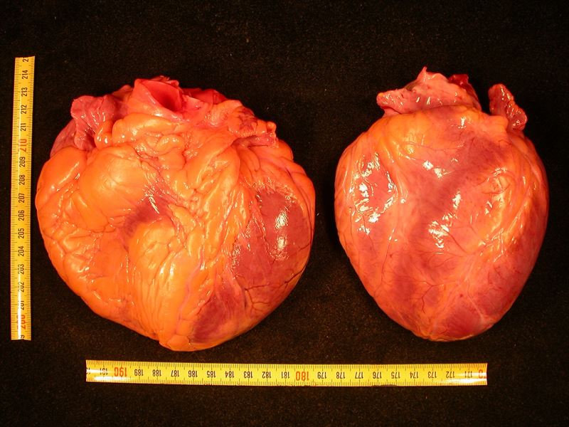 Ejemplo de un corazón con miocardiopatía dilatada. | CEDIDA