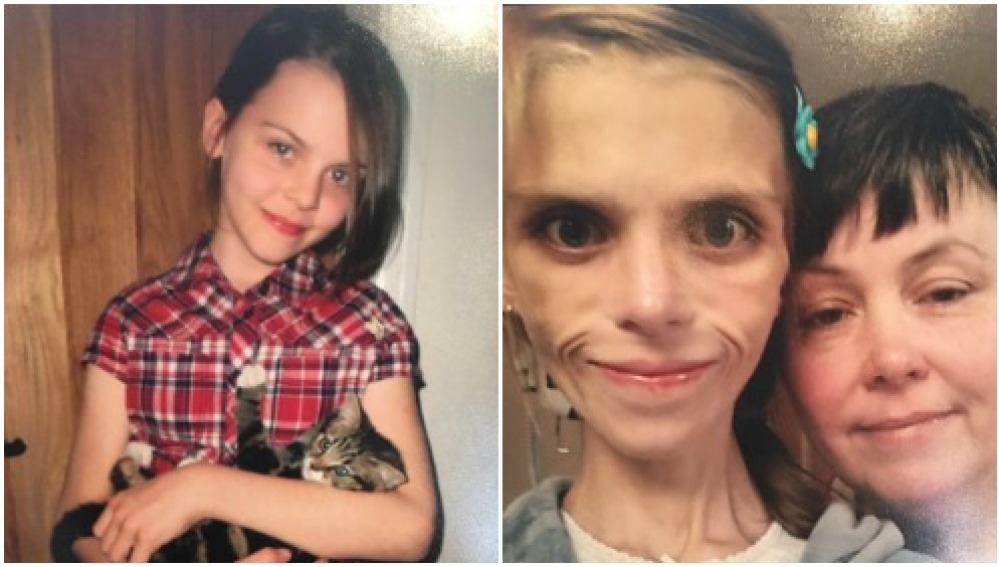 Pippa, la adolescente con anorexia que acabó suicidándose. DA