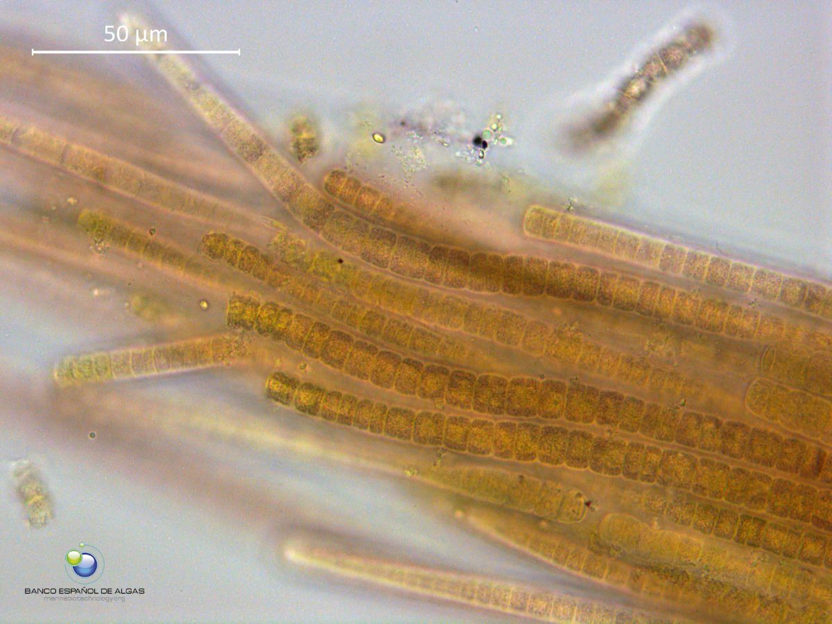 Imagen al microscopio de las cianobacterias que forman las manchas en zonas de las costas canarias. BEA