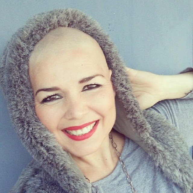 Hilda Siverio, mostrando orgullosa su lucha contra el cáncer. / DA