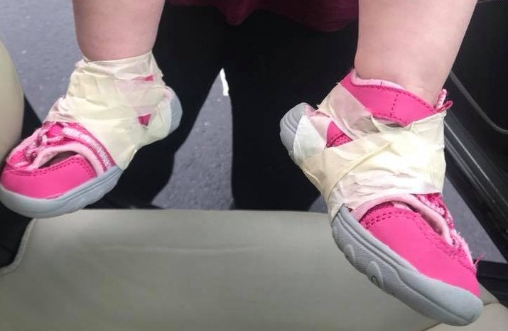 Los pies de la pequeña, con la cinta atada. / METRO