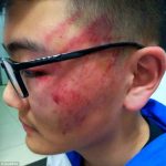 Heridas dejadas en el rostro del alumno. / DAILY MAIL