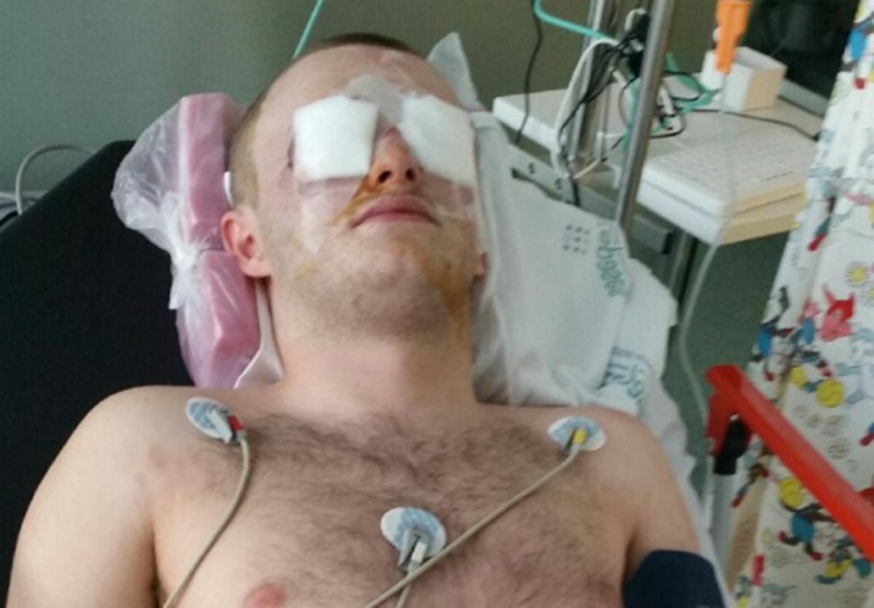 El joven herido por la pistola de pintura. / THE SUN