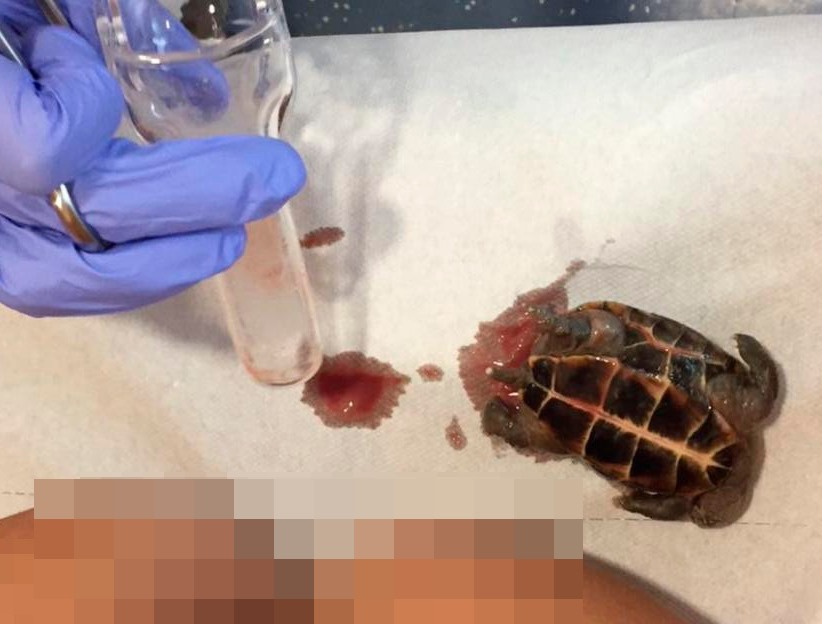 Acude al Hospital del Sur con fuertes dolores y encuentran una tortuga muerta en su vagina. / DA