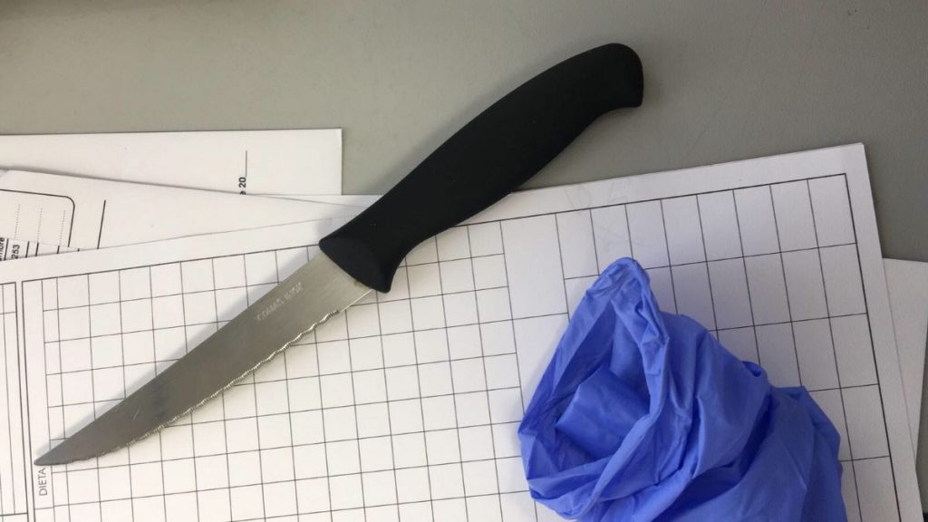 Imagen del cuchillo con el que fue agredida la enfermera ayer en Urgencias de La Candelaria. DA