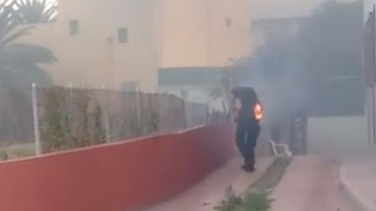 El hombre herido muy grave tras las quemaduras producidas en el incendio.