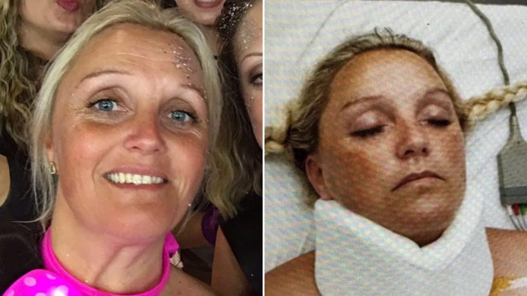 Bonnie antes y después del accidente que sufrió en Magaluf en 2017. El Español