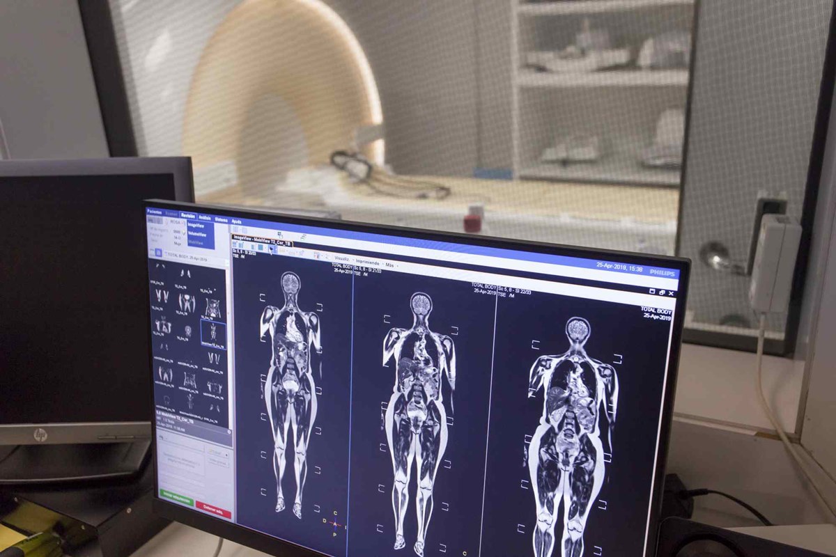 Hospiten incorpora las tres primeras resonancias magnéticas con bobinas digitales en Tenerife y Lanzarote