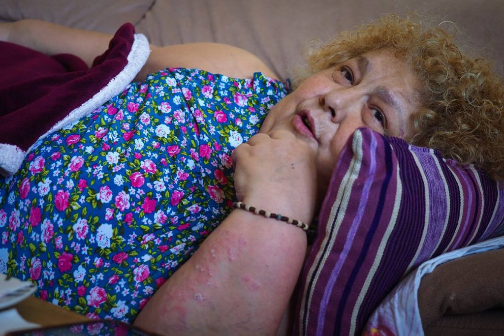María Isabel Socas, que espera durante más de seis meses por una prueba para operarse, atiende a DIARIO DE AVISOS en su piso de La Laguna. Sergio Méndez