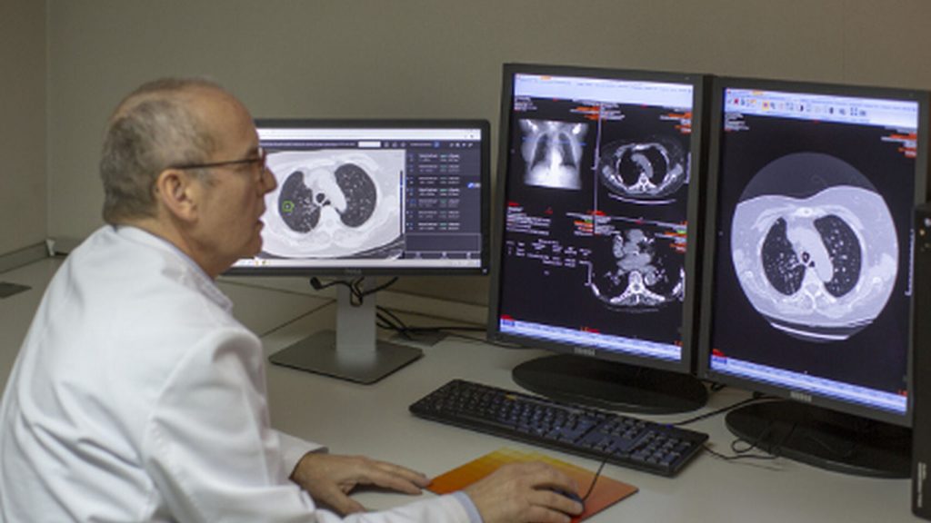Este nuevo análisis de sangre detecta el cáncer de pulmón 4 años antes de los síntomas. E.E.