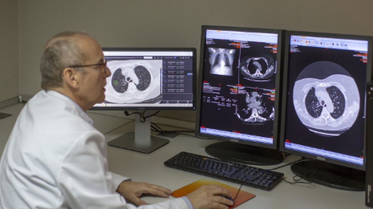 Este nuevo análisis de sangre detecta el cáncer de pulmón 4 años antes de los síntomas. E.E.