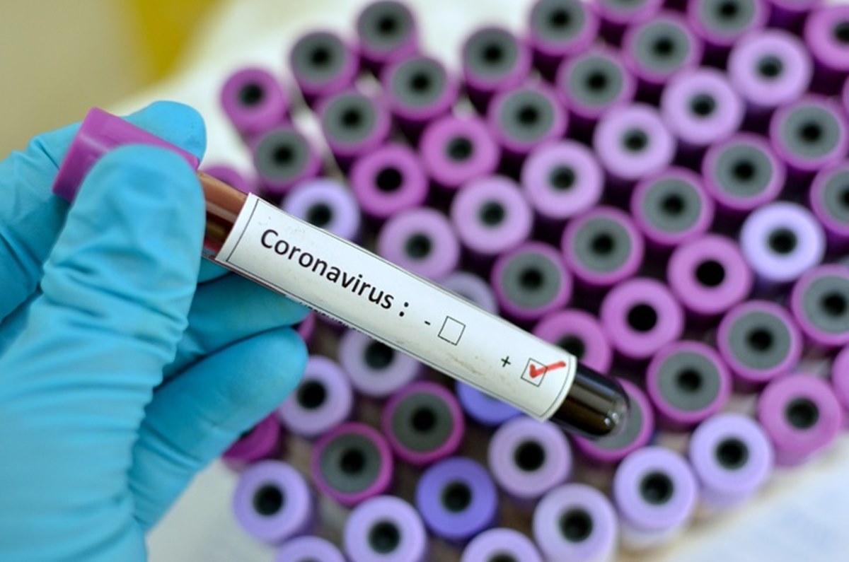 Coronavirus test positivo