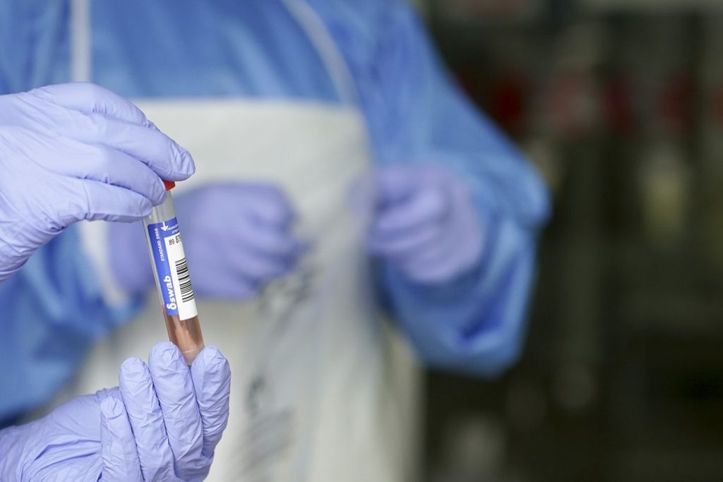 Un sanitario protegido con guantes sostiene un muestra para realizar un análisis PCR