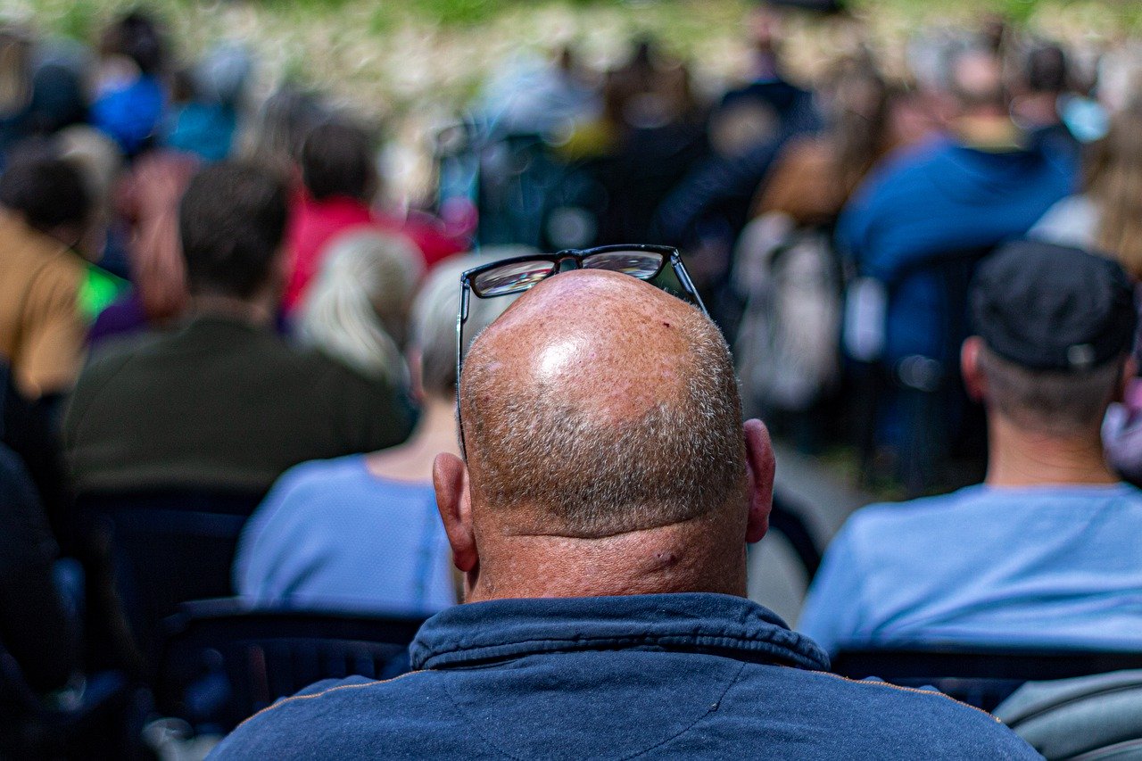 Alopecia PIXABAY