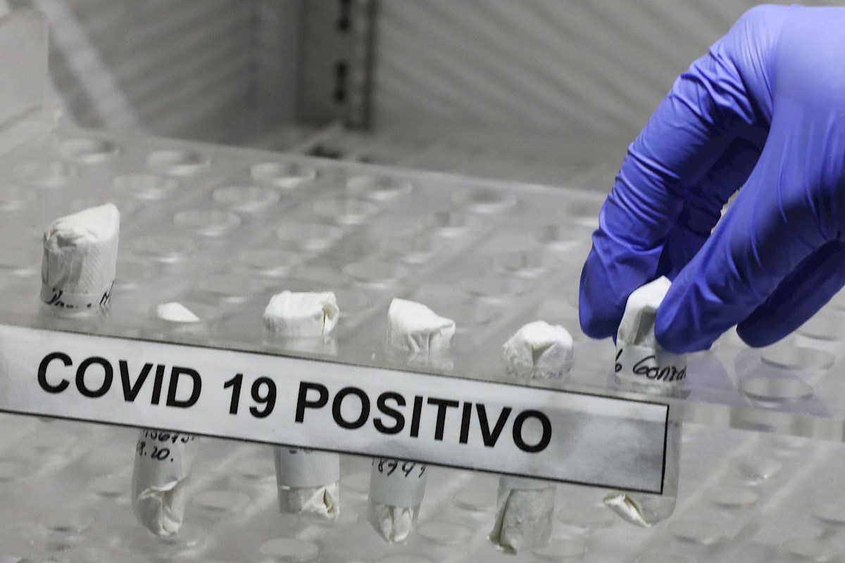 TEST PCR COVID CORONAVIRUS POSITIVO