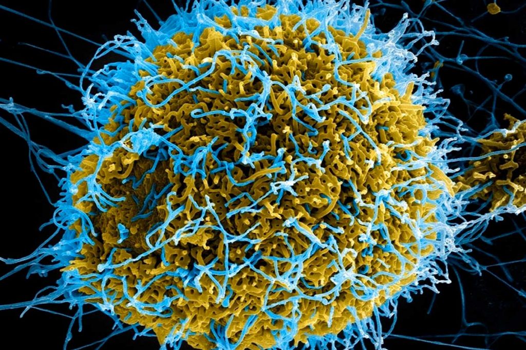 Filamentos del virus del ébola