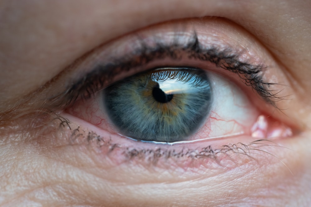 El rasgo de los ojos que 'anuncia' un infarto 5 años antes de que ocurra