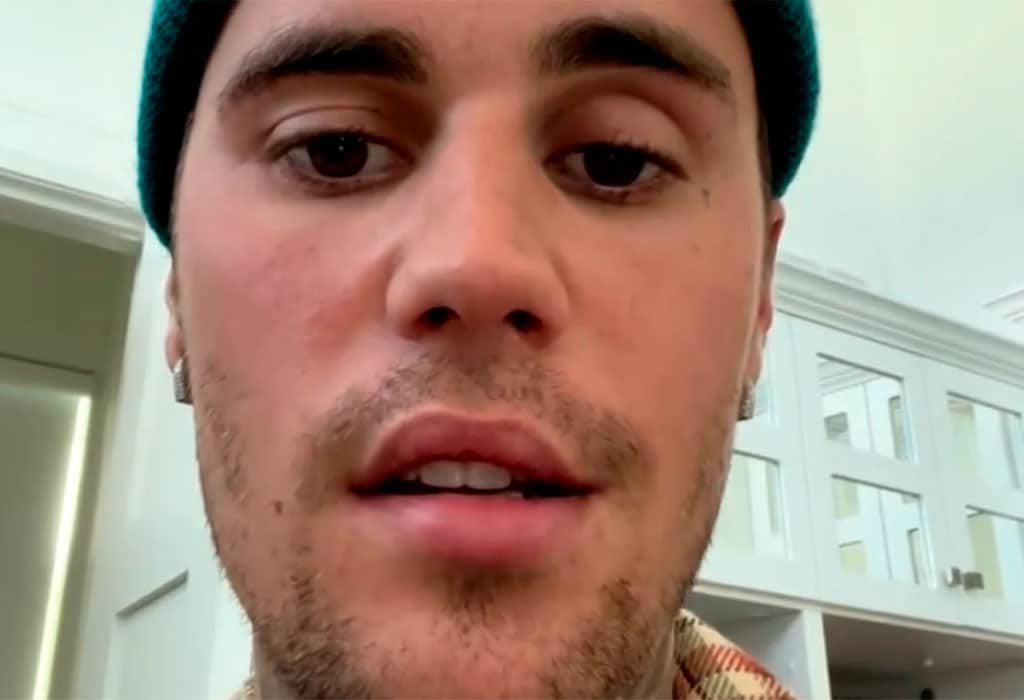 Justin Bieber padece un síndrome que le produce parálisis facial