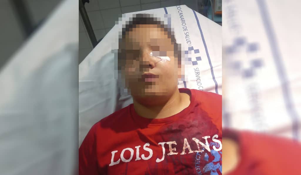 Identifican a los agresores de un niño de once años por defender a su abuelo en La Laguna