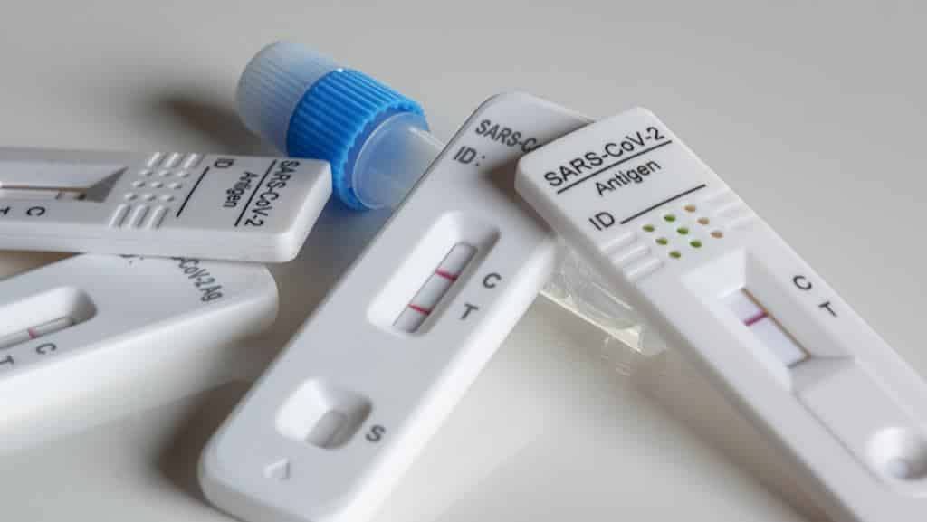 El aumento de casos Covid sube las ventas de test de antígenos en Canarias