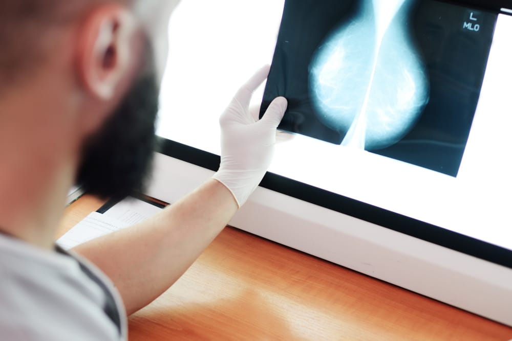 Pide una mamografía, se la deniegan y meses después le diagnostican cáncer de mama