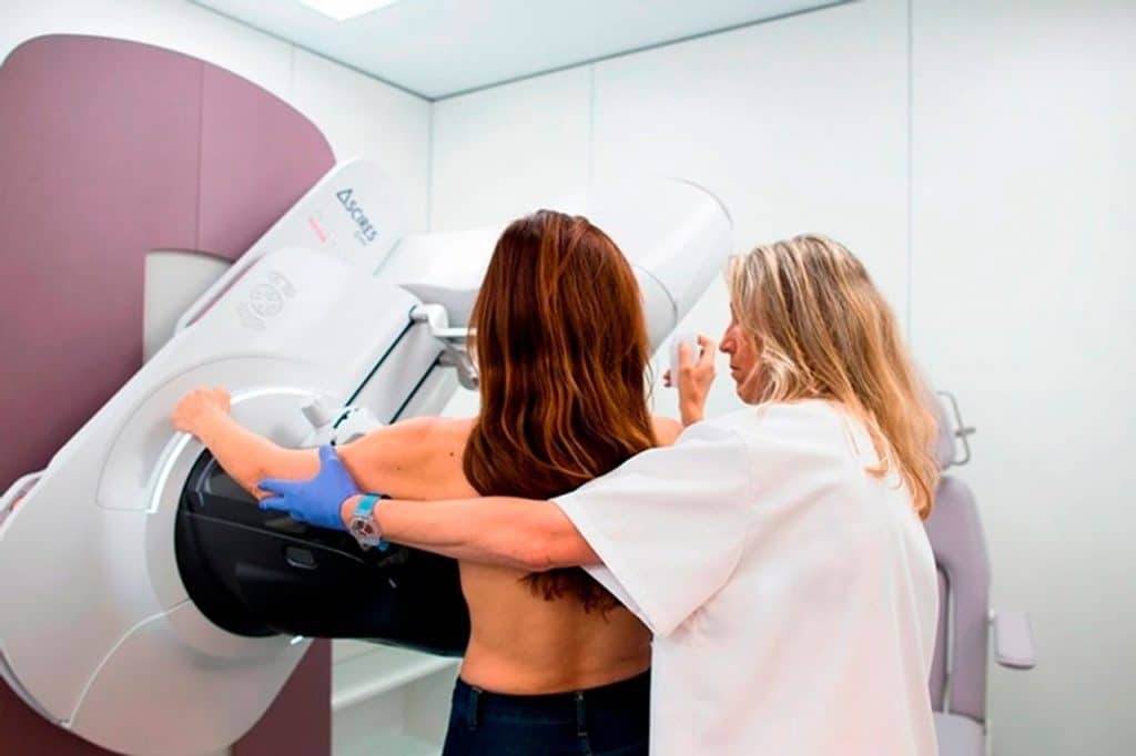 Ámate pide a Sanidad adelantar a los 40 años la edad para iniciar el cribado de cáncer de mama en Canarias