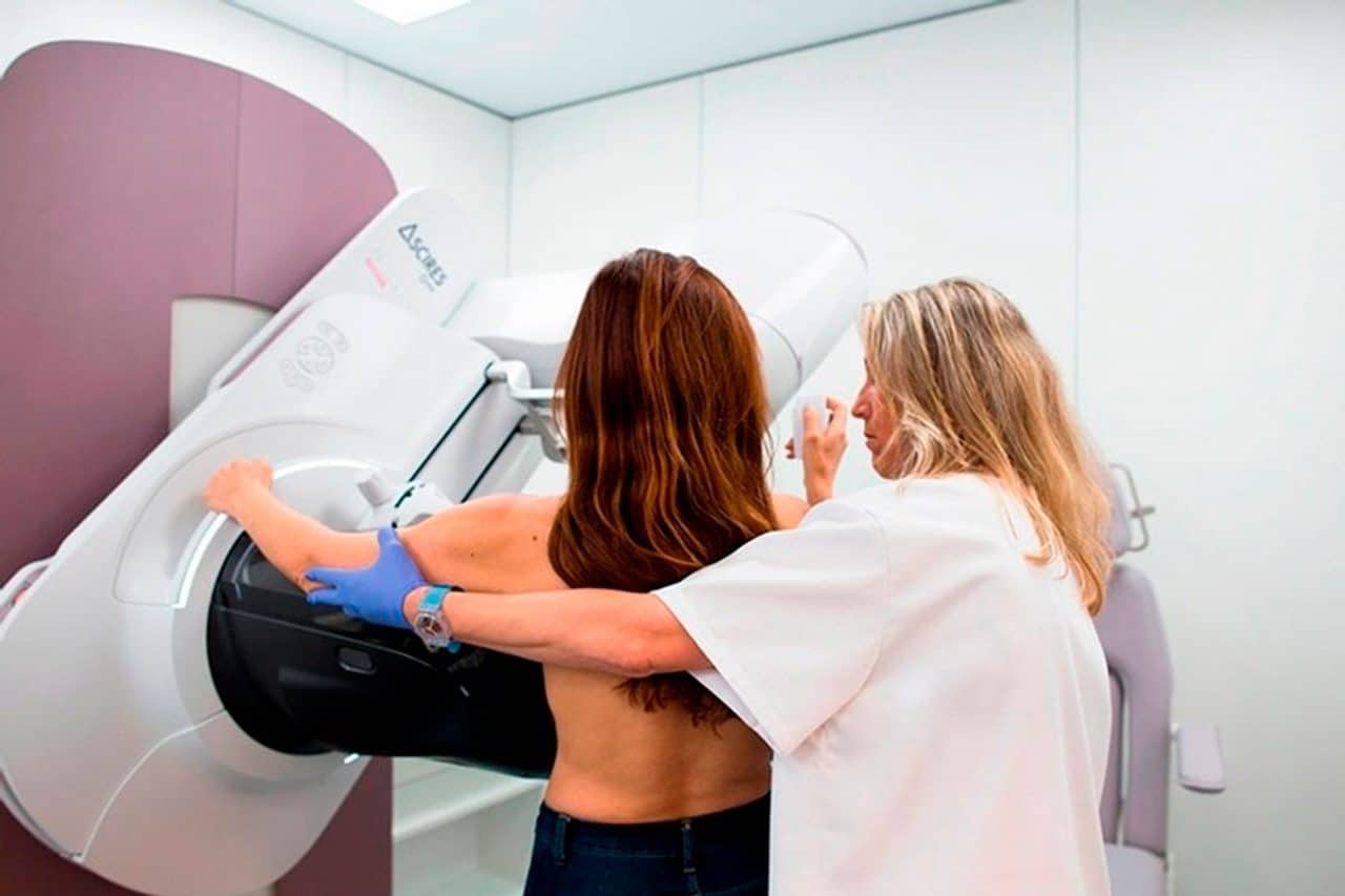 Ámate pide a Sanidad adelantar a los 40 años la edad para iniciar el cribado de cáncer de mama en Canarias