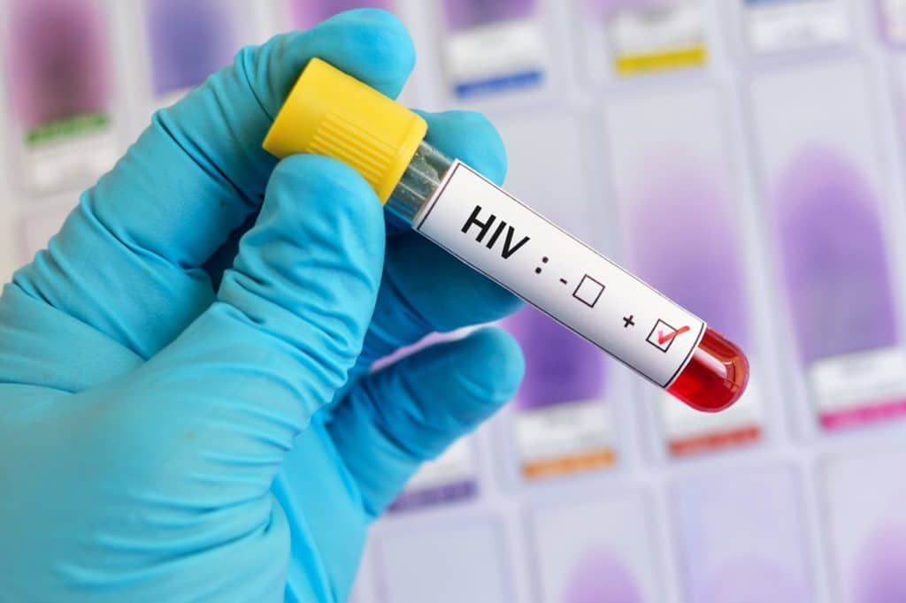 Canarias notifica 207 infecciones por VIH, el 86% en varones