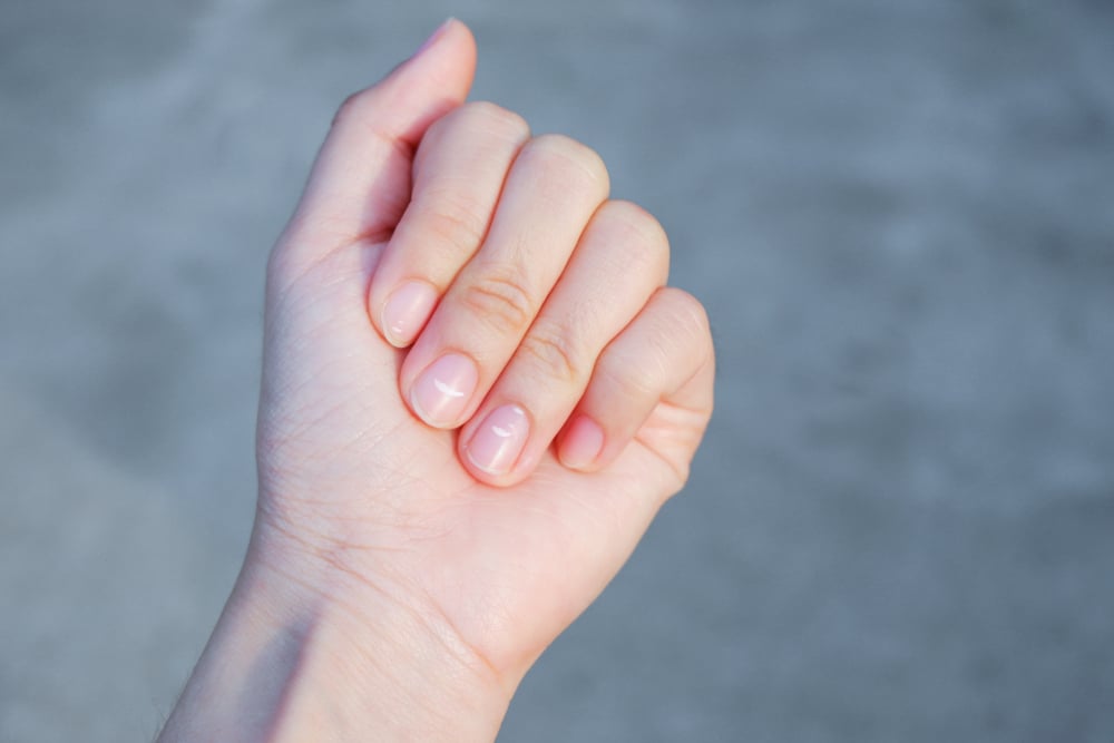 La importancia de mirarse las uñas: sus marcas podrían revelar enfermedades