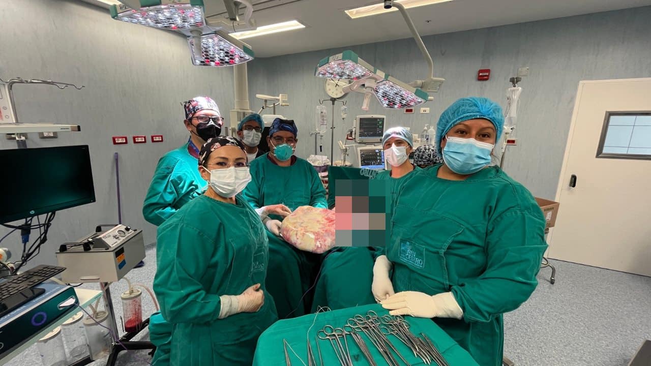 Le extraen un tumor de 20 kilos
