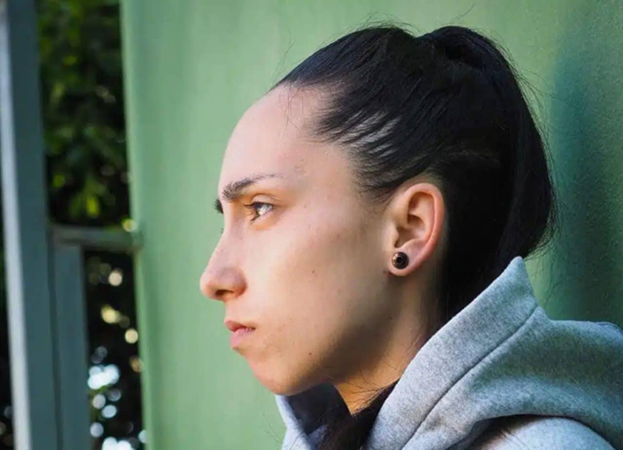 La tinerfeña Vanessa Abreu, paciente con TCA, se reúne con el diputado del común