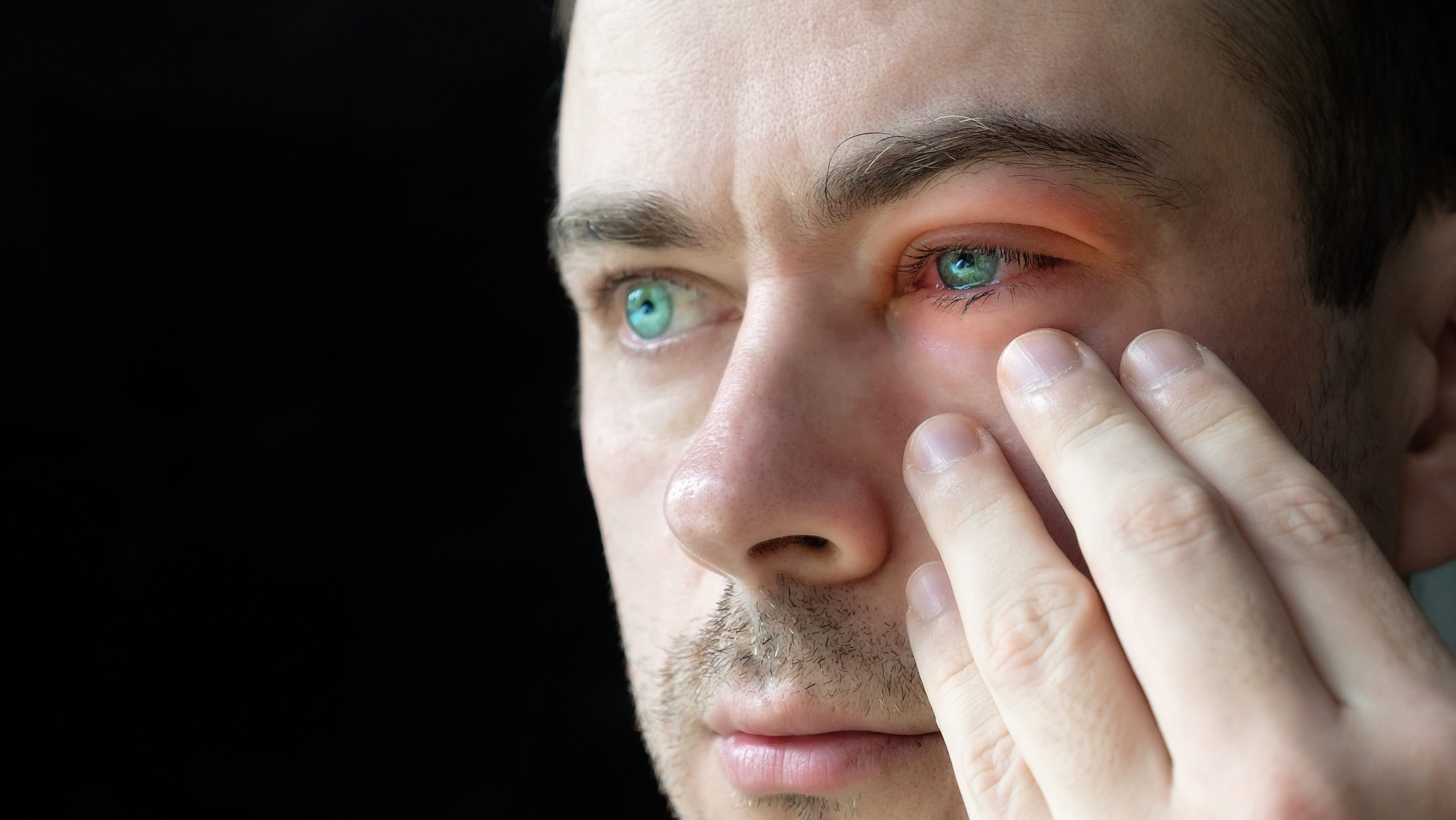 Conjuntivitis