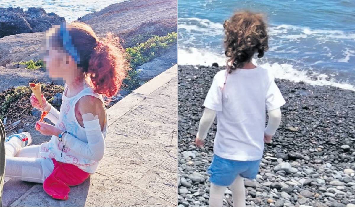 Ylenia y Jacqueline: un equipo contra la piel de mariposa