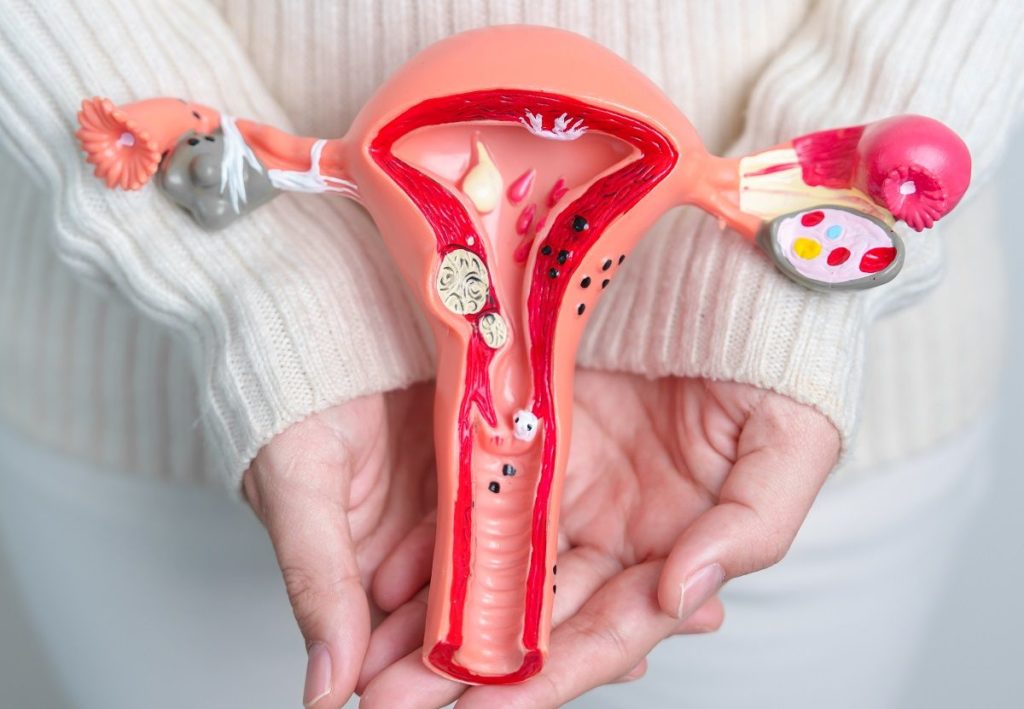 Cirugía de cáncer de ovario: todo lo que necesitas saber