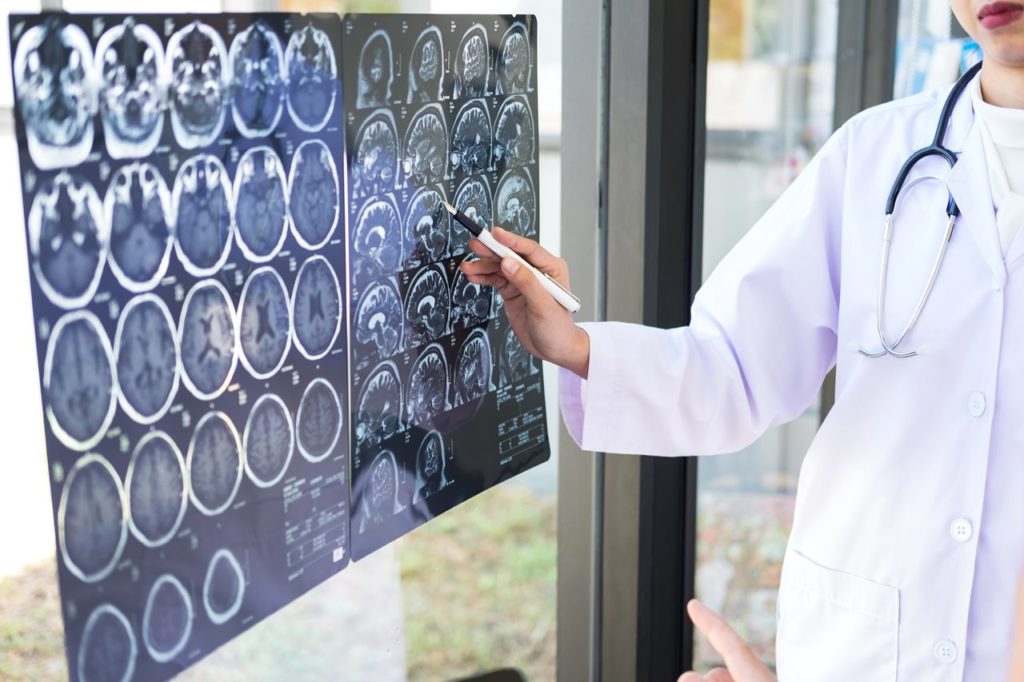 Radiografía cerebral de un paciente. Imagen de recurso