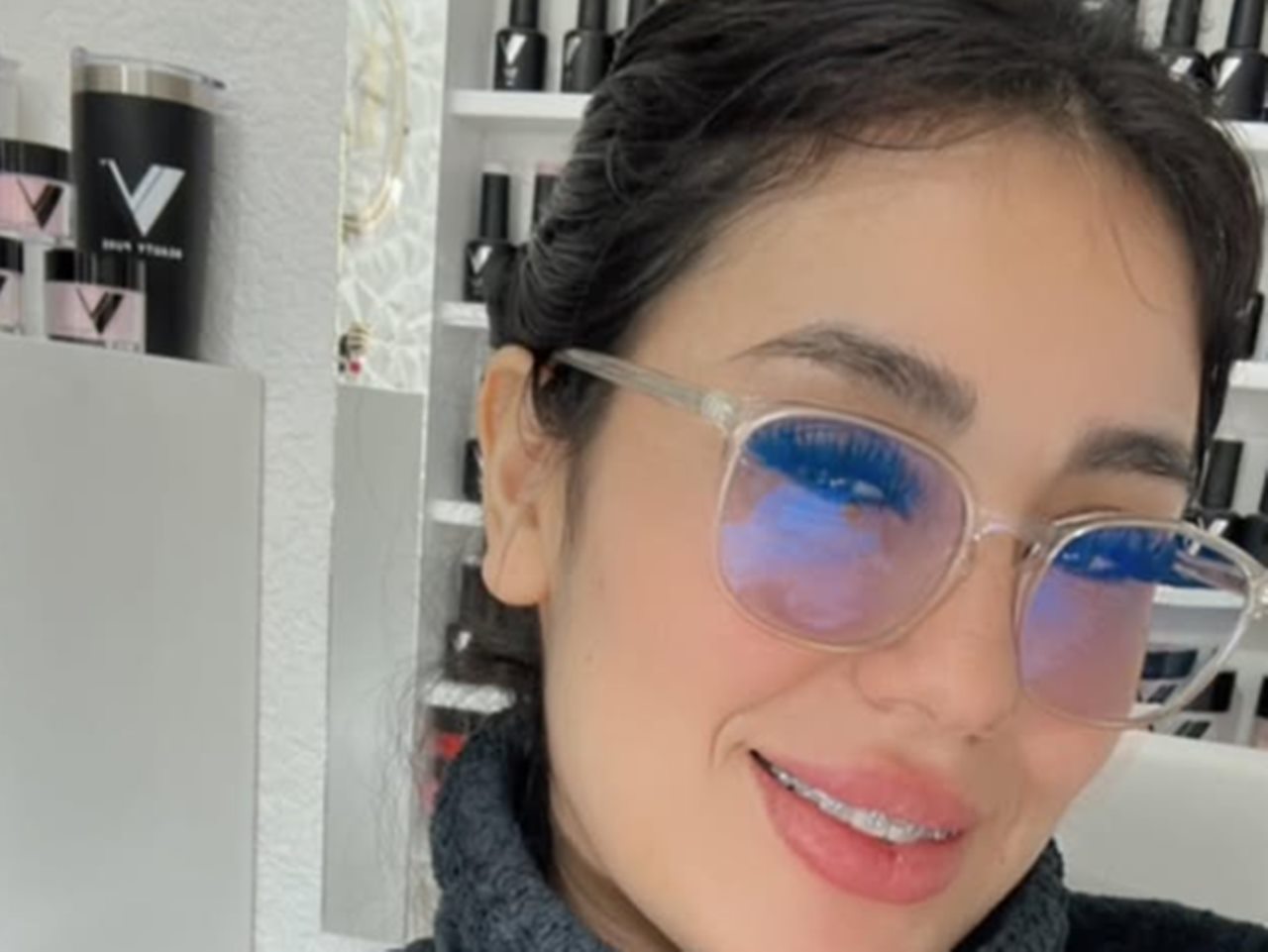 Muere a los 29 años la influencer Asli Fernández durante un Mommy Makeover