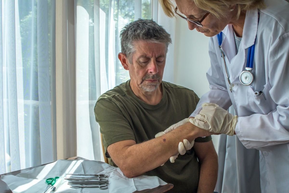 579 casos de cáncer de piel en Tenerife en 2024. DA
