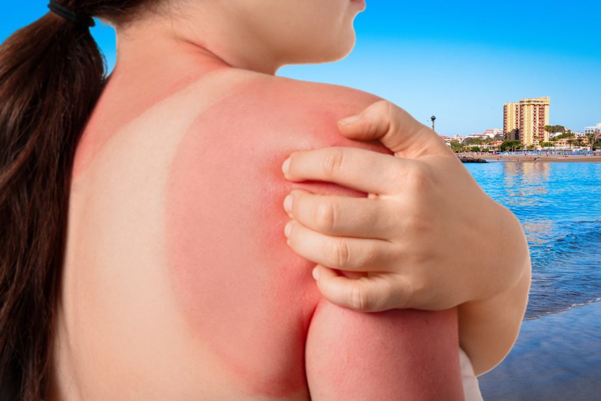 Canarias mantiene el riesgo extremo por radiación y pide evitar la exposición al sol "a cualquier hora"