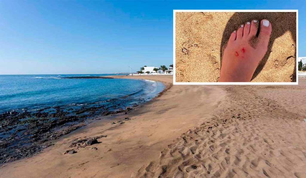 Susto en una playa de Lanzarote: una joven sufre la mordedura de un tiburón angelote