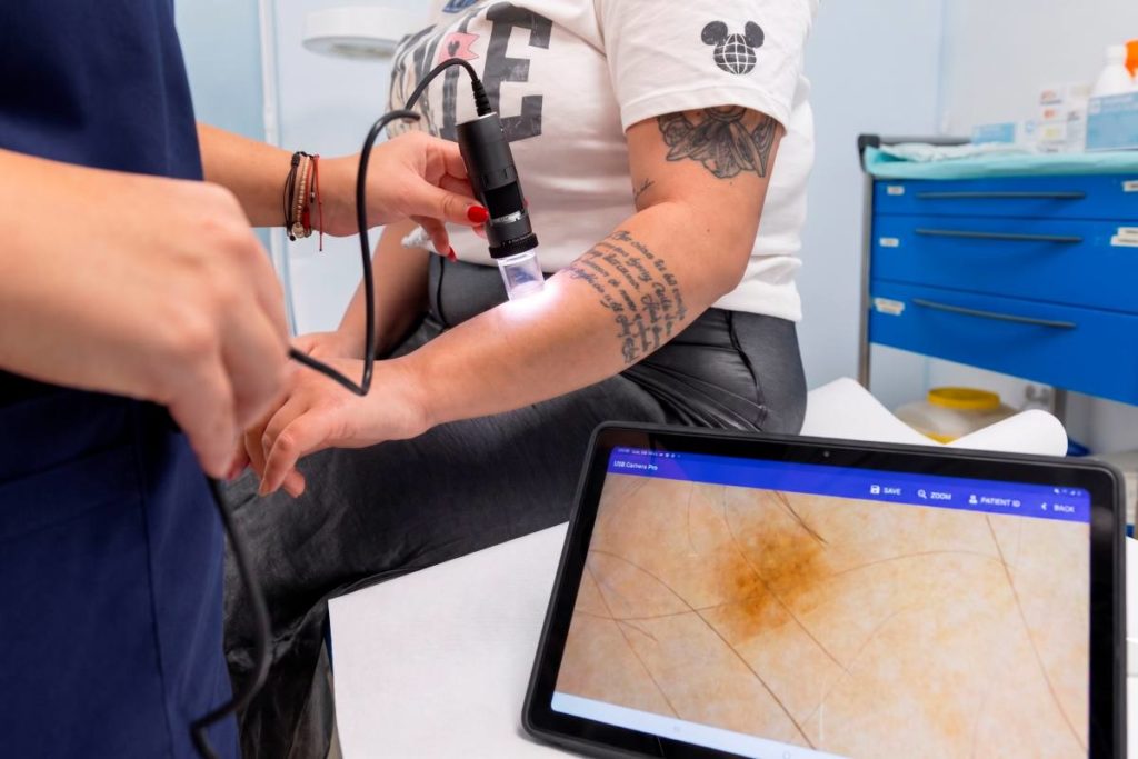 Hospital Parque potencia la teledermatología para facilitar la detección de lesiones cutáneas