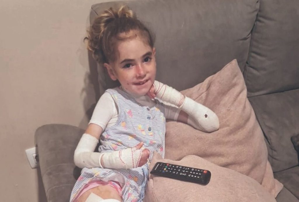 Ylenia, 10 años, convive desde su nacimiento con la Piel de Mariposa. | DA