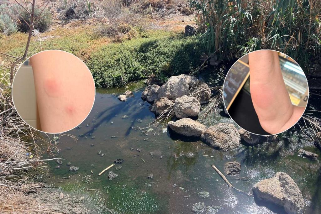 Preocupación en La Tejita por los mosquitos: denuncian una fuerte proliferación desde hace tres años