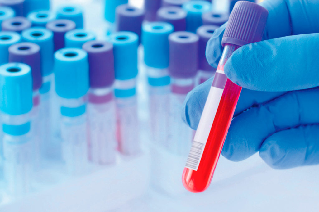 Preocupación por el aumento de las infecciones sexuales en Canarias